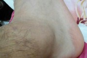 打篮球时防守员手臂疼的原因及预防方法（避免运动伤害，享受篮球乐趣）